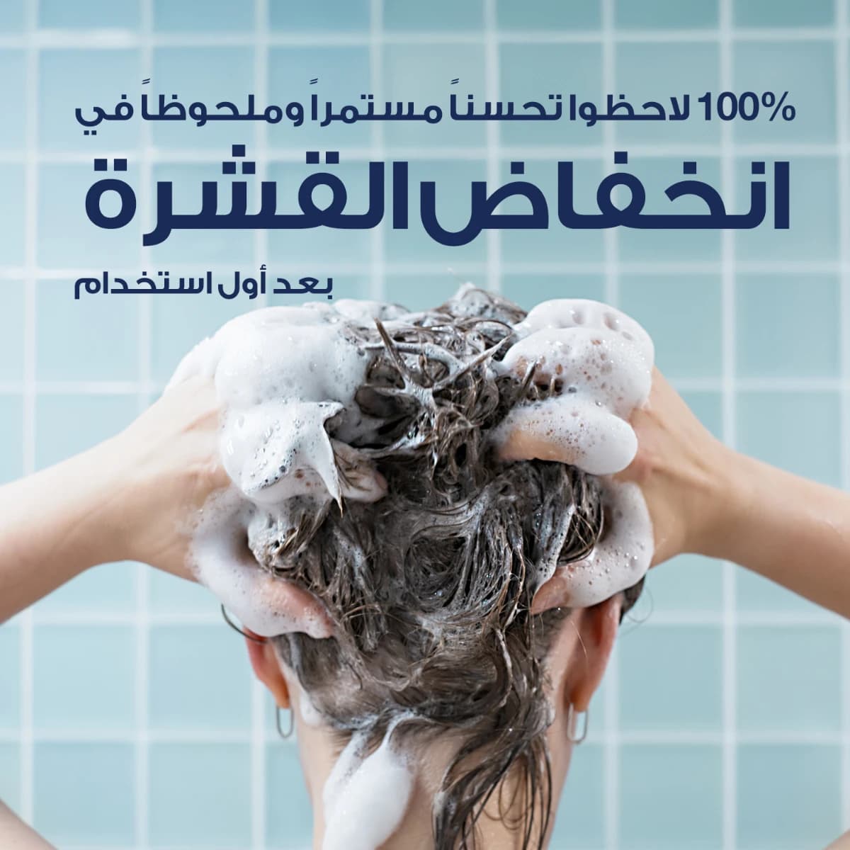 Nizoral, Daily Care, Anti-Dandruff Shampoo – 200 Ml (Image 3 of 5)
