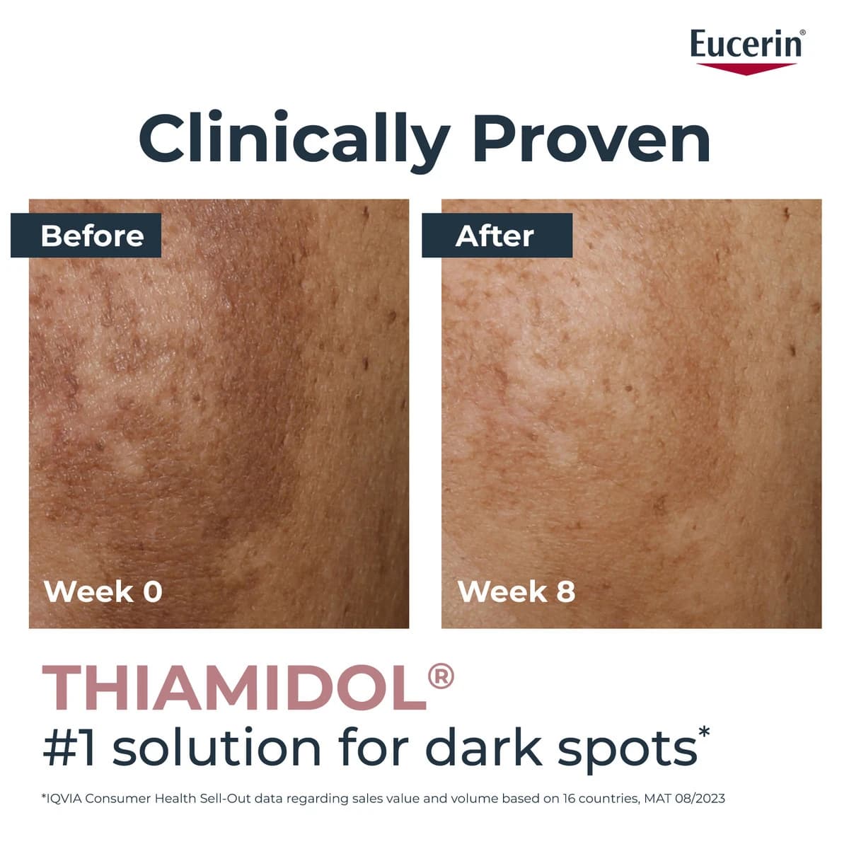 Eucerin, Even Pigment Perfecting - Illuminating Serum - 30Ml (Image 1 of 2)